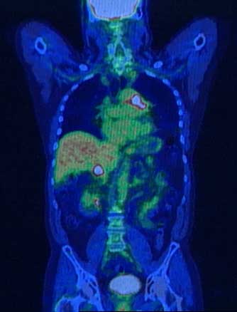 PET/CT image