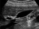 Abdominal ultrasound image