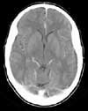 CT image