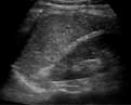 Abdominal ultrasound image