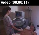 Doppler ultrasound video